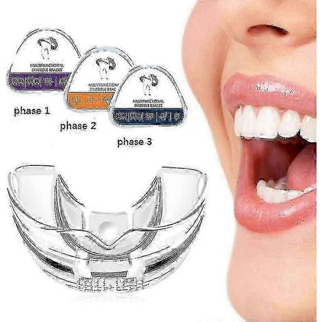 Correcteur dentaire orthodontique en 3 phases Myobrace 2025
