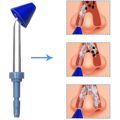 Lot de 9 embouts de rechange pour hydropulseur Waterpik. Pièces détachées pour hydropulseur et jet dentaire Waterpik. (1/5)