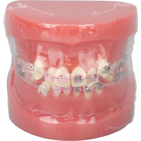 Modèle Dentaire Démontable pour Enseignement et Recherche en Orthodontie (1/5)