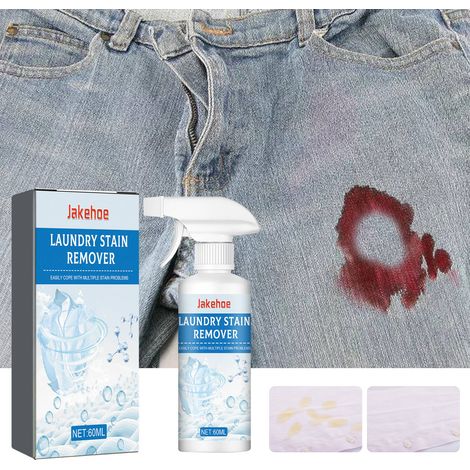 Trockenreinigungsmittel für Kleidung, entfernt hartnäckige Flecken, Ölflecken und Vergilbung – 60 ml -- DE (1/5)
