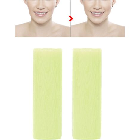 Kaubonbons für Zahnspangen und kieferorthopädische Behandlungen (Apfelgeschmack) (1/5)