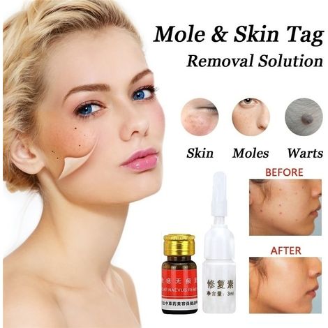 Solution crème anti-lésions cutanées + huile éliminatrice de grains de beauté et taches brunes, soin réparateur visage. (1/5)
