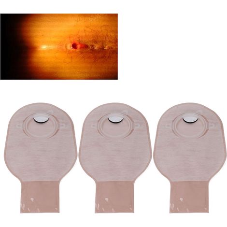Sac à colostomie non tissé modèle Anorectal - Kit de 10 pièces avec ouverture et trois accessoires - 27x7cm / 10.6x2.8in (1/5)