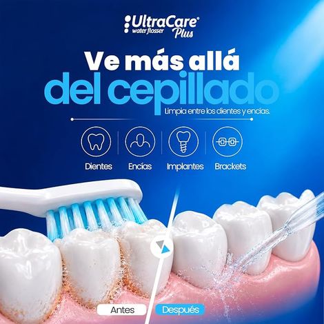 Hydropulseur dentaire portable, hydropulseur buccal sans fil USB-C avec embouts, réservoir 300 ml, jet d'eau pour orthodontie, implants et voyage (1/4)