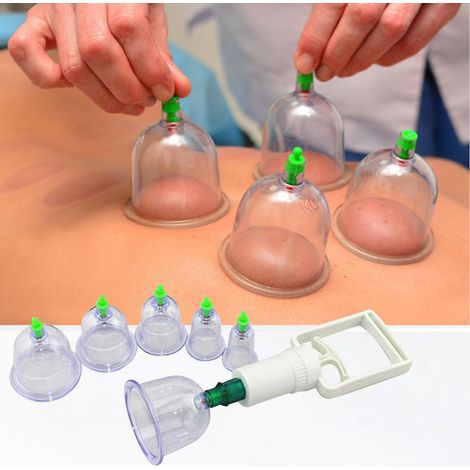 1 ensemble de 6 ventouses Hijama avec pompe à vide pour massage corporel et soulagement des douleurs dorsales et de la cellulite. (1/5)