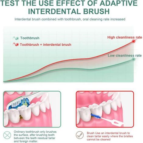 Brosse Interdentaire - Tête En Élastomère Et Cure-Dent Intégré - Pour Appareils Dentaires Et Implants - 160 Pièces (1/5)