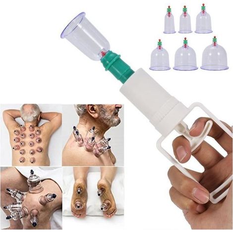 Schröpftherapie-Set – JA – 12 Schröpfgläser – Saugpistole – Anti-Ermüdung – Unisex (1/5)