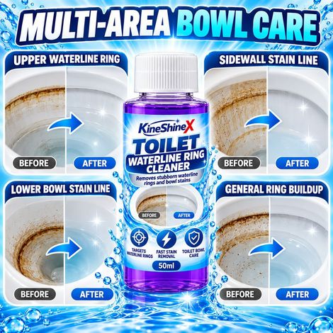 KineShineX Toilet Seat Cleaner for Stubborn Stains and Leaks, Toilet Seat Line Removal Liquid (1/4)