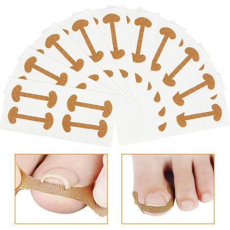 Autocollants de Correction des Ongles 40Pcs Traitement d'ongle de Paronychia Récupérer Ruban Adhésif d'Ongle Incarné Autocollant en Coton élastique Patch d'Ongles Patch des Orteils Outil de Pédicure (1/5)