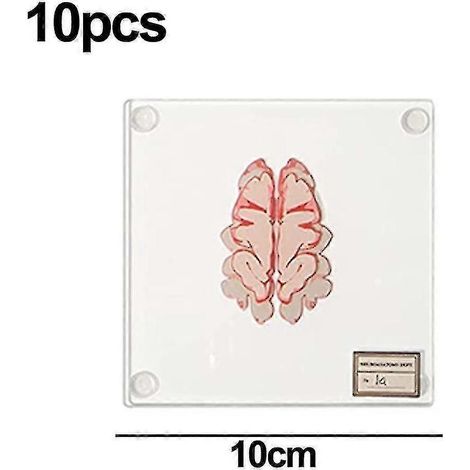 Untersetzer mit anatomischem Gehirnpräparat – Geschenkideen für Medizinstudenten, Gehirndeko, Geschenke zur menschlichen Anatomie (1/4)