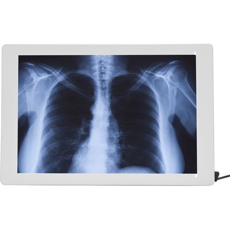 Hochleistungs-LED-Betrachter (36 x 24 cm) für Röntgenbilder, 100–240 V Wechselstromnetzteil mit EU-Stecker (1/5)