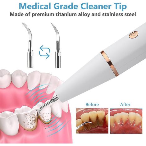 dtartreur Dentaire Ultrasons Pour Les Dents Tartre Tache De Dents Calcul Dentaire Remover Lectrique Sonic Dents Plaque Cleaner Dental Stone Remov (1/5)