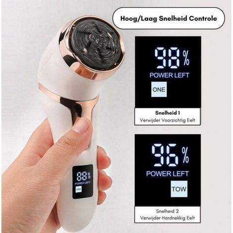 Ponceuse Électrique pour Pieds avec Aspiration, Motorisation Puissante, USB Rechargeable, Étanche, Couleur Blanc et Rose Or Femeo (1/5)