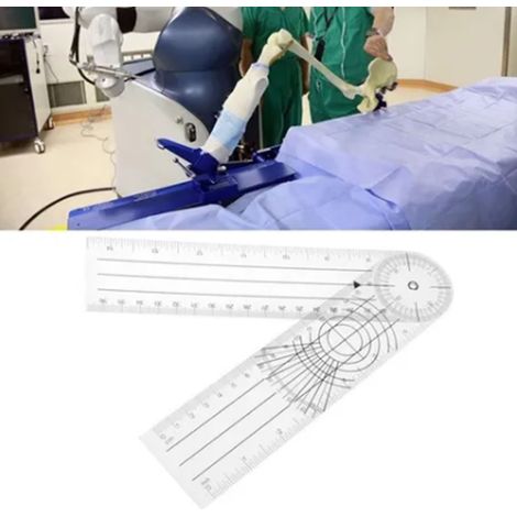 Multifunktionales medizinisches orthopädisches Lineal, Winkelgoniometer zur Messung menschlicher Gelenke und Knochen, Präzisionsmessinstrument. (1/5)