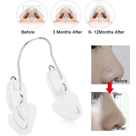 Redresseur Nasal Transparent pour un Nez Parfait et Symétrique (1/5)