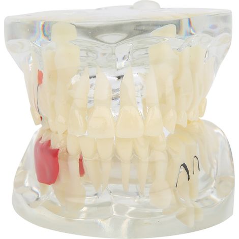 Deciduous Teeth Pathological Model Laboratory Scientific Research Instruments Hospital Teaching Apparatus (1/5)