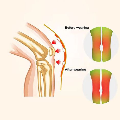 1 Paire de Genouillères Chauffantes à l'Armoise pour Course à Pied, Protection Articulaire contre les Blessures du Genou et l'Arthrite (1/5)