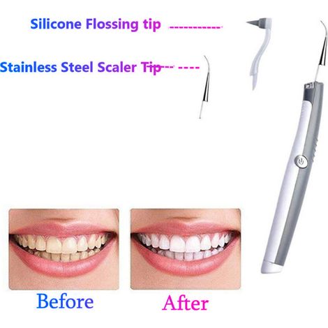 Éliminateur de taches dentaires électrique à ultrasons, outil de blanchiment des dents vibrant, kit de nettoyage de plaque dentaire, beauté buccale (1/5)