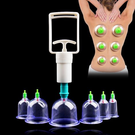 Kit de 6 tasses pour soins corporels traditionnels : kit médical de ventouses, aimants de massage, thérapie par acupression, kit d'aspiration pour la santé (1/4)