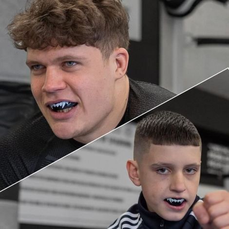 Protège-dents pour Boxe Slim - Noir - Ajustement parfait - Confortable et respirant - Avec étui de rangement (1/4)