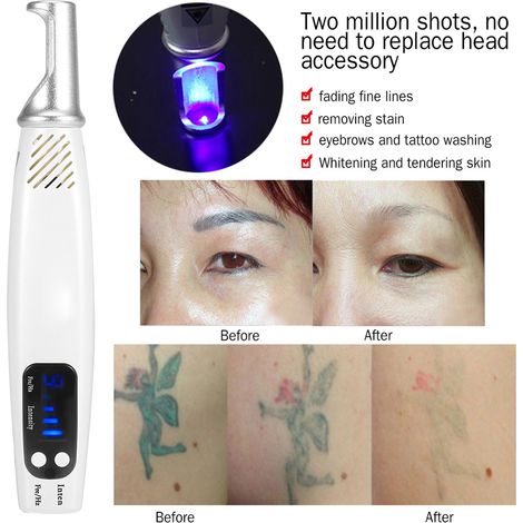 Stylo laser picoseconde portatif pour l'élimination des tatouages, cicatrices et taches de rousseur, appareil de beauté de la peau (1/5)