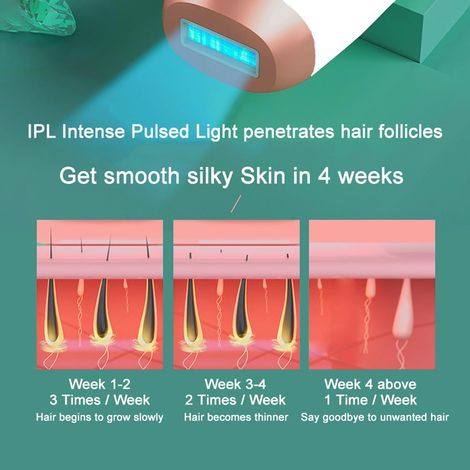 Système d'épilation pour femmes - Épilation laser de luxe, appareil d'épilation IPL compact et portable pour une utilisation à domicile (500 000 flashs) (1/5)