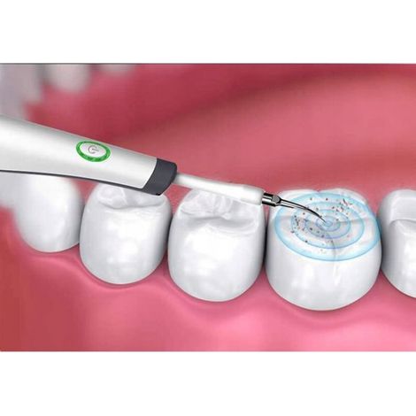 Cobye -Détartreur Dentaire Ultrasons - Soin dentaire- Nettoyage Dents - Élimination Tartre - Hygiène Bucco-Dentaire (1/5)