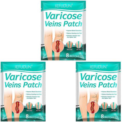 Traitement professionnel des varices des jambes, soulagement des points noirs, amélioration de la circulation sanguine (1/5)