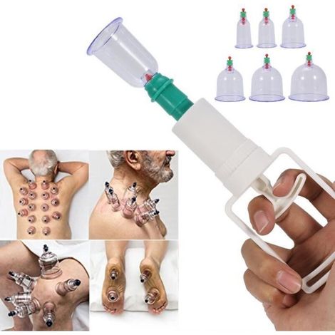 Kit de thérapie par ventouses - YES - 12 Cupping Ventouse - Pistolet d\'aspiration - Anti Fatigue - Mixte (1/4)