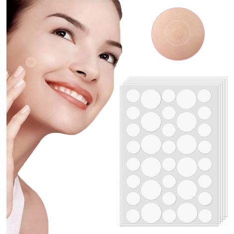 Patchs anti-acné Rpanle, patchs hydrocolloïdes anti-acné, 180 patchs, 2 tailles : 8 mm et 12 mm. Invisibles, pour le traitement des imperfections cutanées. (1/5)