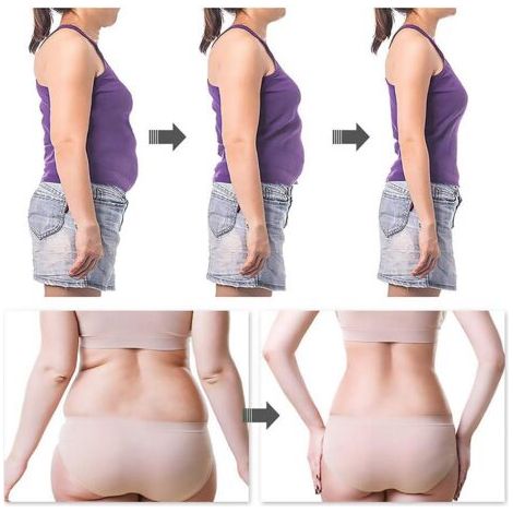 patch minceur Belly 60 pièces - Fat-burning détox autocollant pour minceur, polyvalent et pratique, pour un usage quotidien (1/5)