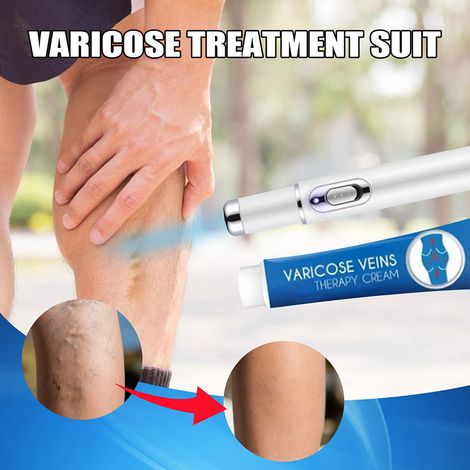 Lot de Thérapie par Lumière Bleue pour Varices - Crème Anti-Varices et Stylo à Lumière Bleue, Traitement des Jambes, Rituel de Soin à Domicile (1/5)