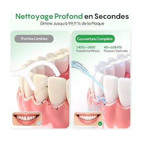 Hydropulseur Dentaire Portable Irrigateur Buccal (1/4)
