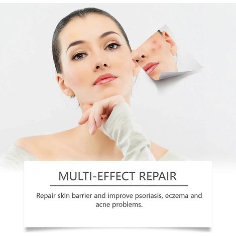 OUHOE Beruhigendes Serum – Spendet sanft Feuchtigkeit und pflegt die Haut – Beruhigendes, feuchtigkeitsspendendes Serum für trockene Haut – 30 ml