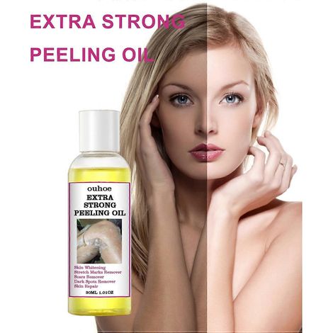 OUHOE 30 ml Extra Starkes Peeling-Öl, Hautaufhellendes und pflegendes Öl, Entfernt Dehnungsstreifen und dunkle Flecken