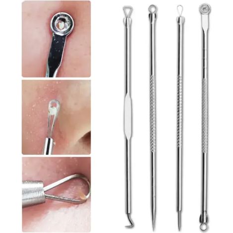 Kit de 4 outils d'extraction de points noirs – Ensemble d'outils professionnels pour l'extraction de points noirs