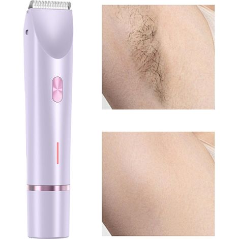 Tondeuse visage pour femmes, tondeuse pour femmes – appareil d'épilation puissant ou appareil d'épilation à sec pour le corps entier (1/5)