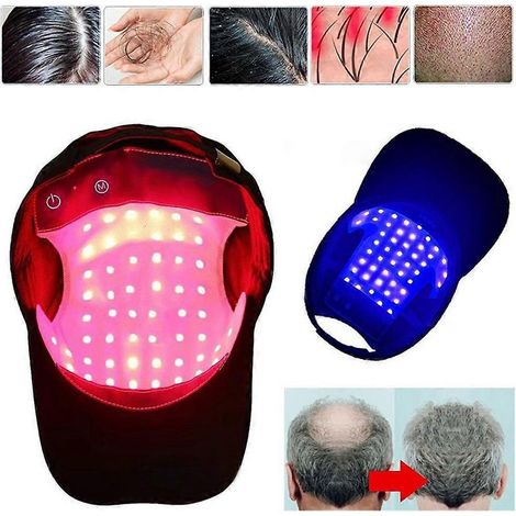 haarausfallbehandlung-mit-rotlichttherapie-laserhelm-zur-forderung-des-haarwachstums-215013327