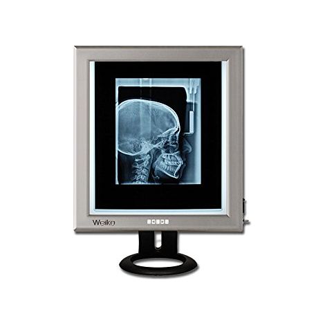 Gima 44705 Negativoscopio Ultrapiatto da Tavolo LED
