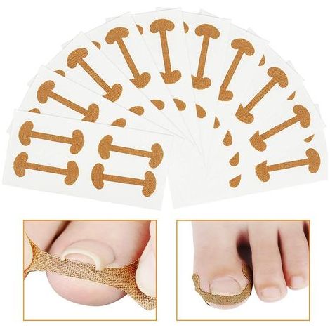 40-teiliges Nagelkorrektur-Set, Nagelbettentzündungsbehandlung, Klebeband gegen eingewachsene Zehennägel, elastische Baumwollaufkleber, Nagelpflaster, Zehenpflaster, Pediküre-Werkzeug