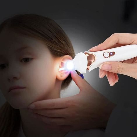 Nettoyeur D Oreille - Aspirateur Electrique Cire Oreille - Pour Adultes Enfants Seniors - 32 dB - Autonomie 1,5 H - USB Rechargeable - 1 Piece (1/4)