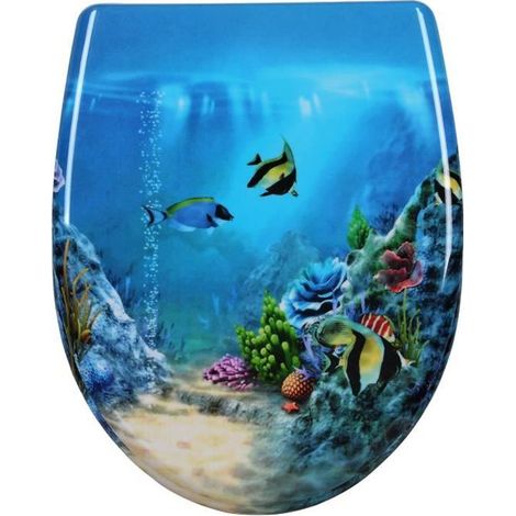 Woltu – Abattant WC en duroplaste – Charnières Fastfix – Système Easy-Close – Dimensions 445x371mm – Antibactérien – Fixation rapide (1/4)