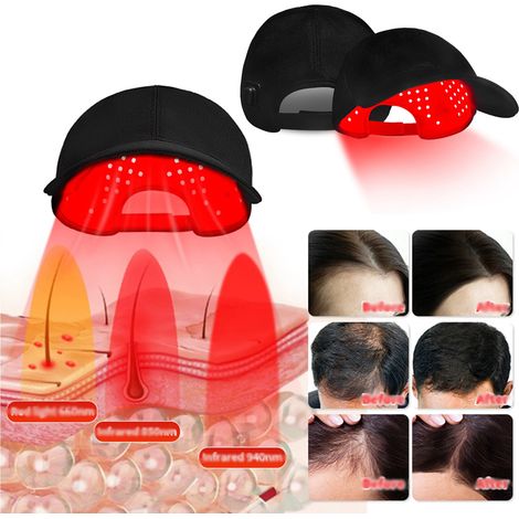 Casque LED Cheveux, Casque Pousse Cheveux, 5 Modes Casque De Croissance De Cheveux 660nm+850nm+940nm, Sans fil Casque Anti Calvitie,Accélérer La Croissance Des Cheveux pour Femme Homme (1/5)