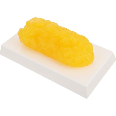Modèle Anatomique de Graisse Humaine Lb Réaliste pour Cours de Nutrition et Motivation Perte de Poids (1/5)