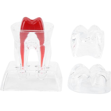 Modèle Dentaire Détachable pour Étudiant en Endodontie - Outil Pédagogique (1/5)