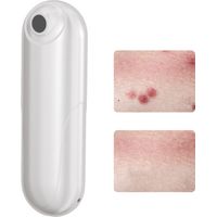Appareil de Soustraction de Piqûres Rechargeable USB - Apaisant pour Moustiques, Abeilles et Guêpes sans Produits Chimiques