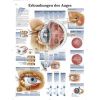 3B Scientific kawe lavagna patologie del occhio, 1